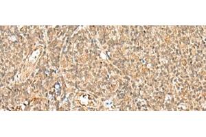 Immunohistochemistry of paraffin-embedded Human tonsil tissue using GTF2A2 Polyclonal Antibody at dilution of 1:30(x200) (GTF2A2 anticorps)