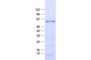 Validation with Western Blot