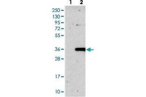 Western blot analysis of Lane 1: Negative control (vector only transfected HEK293T lysate), Lane 2: Over-expression Lysate (Co-expressed with a C-terminal myc-DDK tag (~3. (ROGDI anticorps)