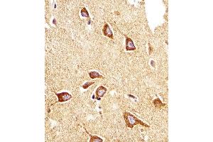Immunohistochemical analysis of paraffin-embedded H.