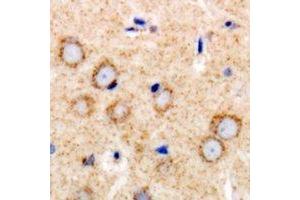 Immunohistochemical analysis of TGFBR2 staining in human brain formalin fixed paraffin embedded tissue section.