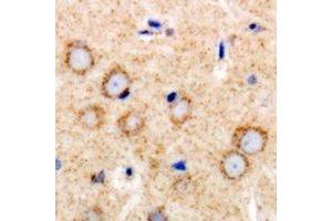 Immunohistochemical analysis of TGFBR2 staining in human brain formalin fixed paraffin embedded tissue section. (TGFBR2 anticorps)