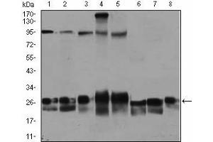 Western Blotting (WB) image for anti-RAB4A, Member RAS Oncogene Family (RAB4A) antibody (ABIN1108812) (Rab4 anticorps)