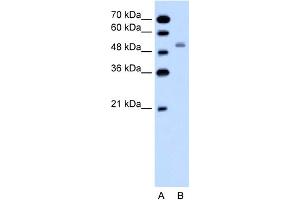 WB Suggested Anti-SLC12A1 Antibody Titration:  0. (SLC12A1 anticorps  (N-Term))