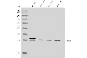 Western blot analysis of GSTA4 using anti-GSTA4 antibody (ABIN7601112).