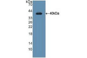 Detection of Recombinant UNG, Human using Polyclonal Antibody to Uracil DNA Glycosylase (UNG) (UNG anticorps  (AA 1-313))