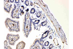 IHC analysis of Bax using anti-Bax antibody . (BAX anticorps  (N-Term))