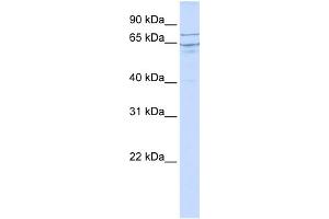 WB Suggested Anti-EDEM1 Antibody Titration:  0. (EDEM1 anticorps  (N-Term))