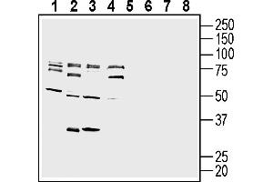 Western blot analysis of mouse  microglia cell line lysate (lanes 1 and 5), mouse J774 macrophage cell line lysate (lanes 2 and 6), mouse M1 myeloid leukemia cell line lysate (lanes 3 and 7) and mouse Neuro-2a neuroblastoma cell line lysate (lanes 4 and 8):1-4. (BDKRB1 anticorps  (Extracellular))