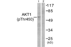 Western Blotting (WB) image for anti-V-Akt Murine Thymoma Viral Oncogene Homolog 1 (AKT1) (pThr450) antibody (ABIN1847255) (AKT1 anticorps  (pThr450))