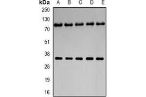 Western blot analysis of Neuroglobin expression in U251 (A), mouse liver (B), mouse brain (C), rat liver (D), rat brain (E) whole cell lysates.