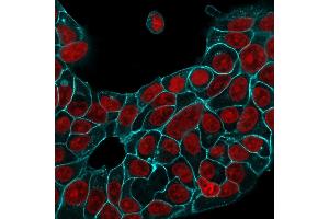 Immunofluorescence Analysis of MCF-7 cells labeling Ep-CAM with EpCAM Rabbit Recombinant MAb (EGP40/1556R) followed by Goat anti-Rabbit IgG-CF488 (Cyan).