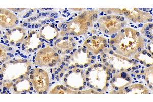 Detection of CASP1 in Human Kidney Tissue using Polyclonal Antibody to Caspase 1 (CASP1) (Caspase 1 anticorps  (AA 317-404))