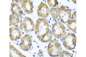 Immunohistochemistry of paraffin-embedded Human stomach using M6PR Polyclonal Antibody at dilution of 1:100 (40x lens). (M6PR anticorps)