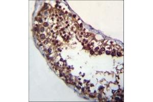 Immunohistochemistry analysis in formalin fixed and paraffin embedded human testis tissue reacted with POMT1 Antibody (C-term) followed which was peroxidase conjugated to the secondary antibody and followed by DAB staining.