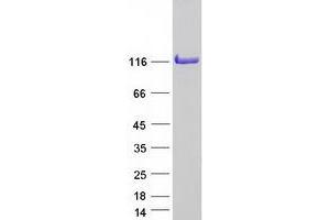 Validation with Western Blot