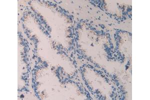 IHC-P analysis of Human Prostate Gland Tissue, with DAB staining. (Contactin 4 anticorps  (AA 731-980))