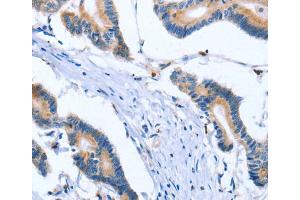 Immunohistochemistry (IHC) image for anti-Polo-Like Kinase 3 (PLK3) antibody (ABIN2422831) (PLK3 anticorps)