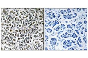 Immunohistochemistry analysis of paraffin-embedded human pancreas tissue using NDUFA3 antibody. (NDUFA3 anticorps  (Internal Region))