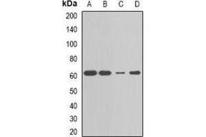 Western blot analysis of CBX4 expression in MCF7 (A), HepG2 (B), Jurkat (C), mouse liver (D) whole cell lysates. (CBX4 anticorps)
