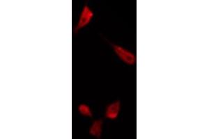 ABIN6266485 staining K562 by IF/ICC. (ENOS anticorps  (C-Term))