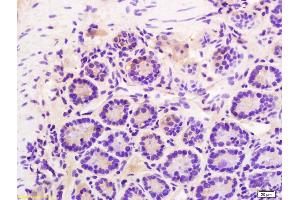Formalin-fixed and paraffin embedded mouse intestine labeled with Rabbit Anti Phospho-Talin (Ser425) Polyclonal Antibody, Unconjugated (ABIN703135) at 1:200 followed by conjugation to the secondary antibody and DAB staining