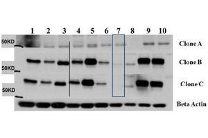 Western Blot of Mouse Anti-AKT3 antibody. (AKT3 anticorps  (Internal Region) (Biotin))