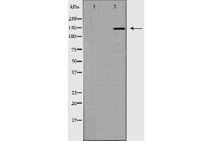 Western blot analysis of ACE1 expression in mouse kidney,The lane on the left is treated with the antigen-specific peptide. (Angiotensin I Converting Enzyme 1 anticorps  (Internal Region))