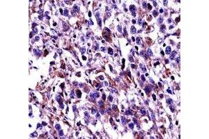 Oct-2 antibody immunohistochemistry analysis in formalin fixed and paraffin embedded human testis carcinoma.