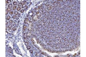 IHC analysis of MCM6 using anti-MCM6 antibody (ABIN7600035). (MCM6 anticorps  (AA 14-821))