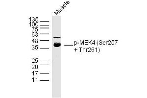 Mouse Muscle lysates probed with p-MEK4(Ser257 + Thr261) Polyclonal Antibody, Unconjugated  at 1:300 dilution and 4˚C overnight incubation. (MAP2K4 anticorps  (pSer257, pThr261))