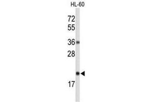 Western blot analysis of RNH2C Antibody (Center) in HL-60 cell line lysates (35µg/lane).