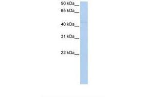 Image no. 1 for anti-Nuclear Receptor Subfamily 2, Group F, Member 1 (NR2F1) (N-Term) antibody (ABIN6738046)