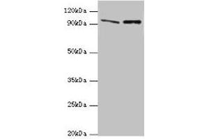 Western blot All lanes: NVL antibody at 10 μg/mL Lane 1: Mouse thymus tissue Lane 2: Hela whole cell lysate Secondary Goat polyclonal to rabbit IgG at 1/10000 dilution Predicted band size: 96, 83, 73, 74, 86 kDa Observed band size: 96 kDa (NVL anticorps  (AA 340-520))