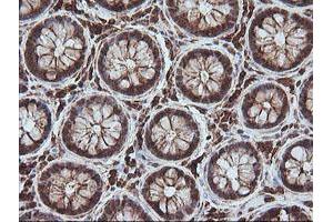 Image no. 1 for anti-Melanoma Antigen Family A, 4 (MAGEA4) antibody (ABIN1499260)