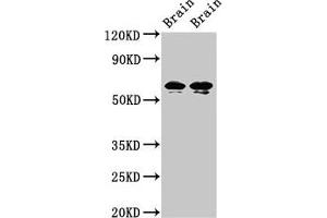 Western Blot Positive WB detected in: Rat brain tissue, Mouse brain tissue All lanes: STXBP1 antibody at 2 μg/mL Secondary Goat polyclonal to rabbit IgG at 1/50000 dilution Predicted band size: 68, 69 kDa Observed band size: 68, 69 kDa (STXBP1 anticorps  (AA 245-594))