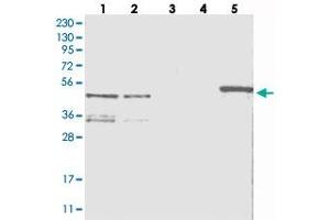 Western blot analysis of Lane 1: RT-4, Lane 2: U-251 MG, Lane 3: Human Plasma, Lane 4: Liver, Lane 5: Tonsil with ZNF641 polyclonal antibody  at 1:250-1:500 dilution. (ZNF641 anticorps)