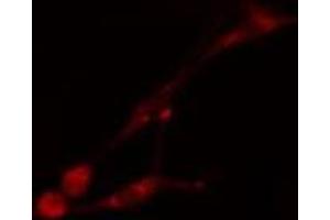 ABIN6275510 staining HT29 cells by IF/ICC. (PHAX anticorps  (Internal Region))