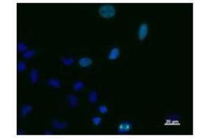 Immunostaining analysis in HeLa cells. (TPX2 anticorps)