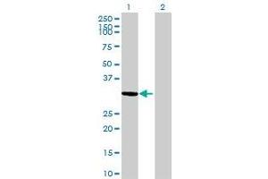 Lane 1: TTC35 transfected lysate ( 34. (KIAA0103 293T Cell Transient Overexpression Lysate(Denatured))