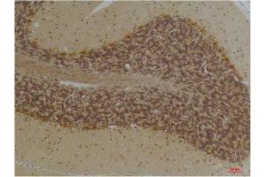 Immunohistochemistry (IHC) analysis of paraffin-embedded Human Brain Tissue using KCNN2(SK2) Rabbit Polyclonal Antibody diluted at 1:200.