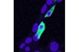 CLIC4 polyclonal antibody  (5 ug/mL) staining of min6 cells transiently expressing mouse clic4. (CLIC4 anticorps)