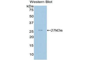 Western Blotting (WB) image for anti-GATA Binding Protein 4 (GATA4) (AA 228-440) antibody (ABIN3208751) (GATA4 anticorps  (AA 228-440))
