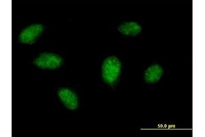 Immunofluorescence of purified MaxPab antibody to BIRC4BP on HeLa cell. (XAF1 anticorps  (AA 1-301))