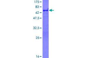 Image no. 1 for Brain Abundant, Membrane Attached Signal Protein 1 (BASP1) (AA 1-227) protein (GST tag) (ABIN1346416)