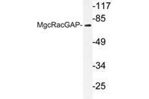 Western blot analysis of MgcRacGAP antibody in extracts from COS7 cells.