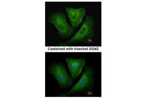 ICC/IF Image Immunofluorescence analysis of methanol-fixed A549, using HLA-DRB3, antibody at 1:500 dilution.