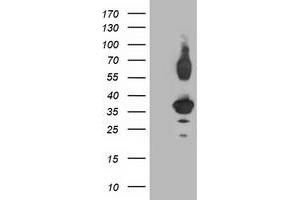 Western Blotting (WB) image for anti-Pleckstrin Homology Domain Containing Family A3 (PLEKHA3) antibody (ABIN1500275) (PLEKHA3 anticorps)