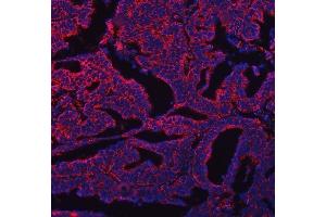 IF analysis of COX5B using anti-COX5B antibody (ABIN7598975).