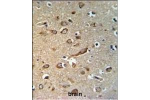 GP Antibody (Center) (ABIN653744 and ABIN2843046) IHC analysis in formalin fixed and paraffin embedded brain tissue followed by peroxidase conjugation of the secondary antibody and DAB staining.